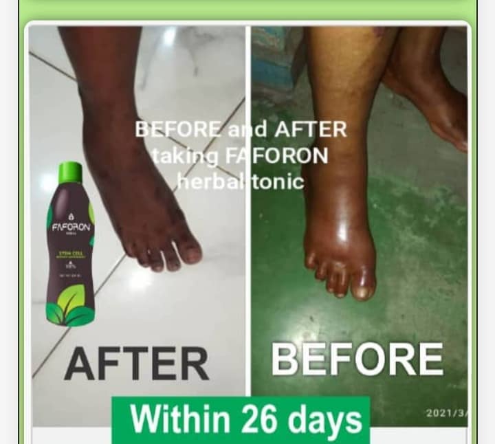 Faforon Herbal Blood Builder